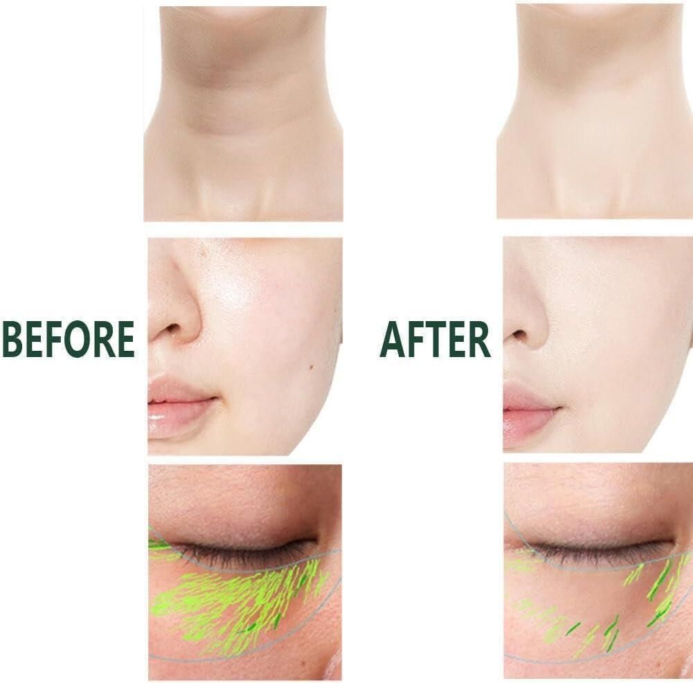 Oakstone SkinLift™ Renewal Wand