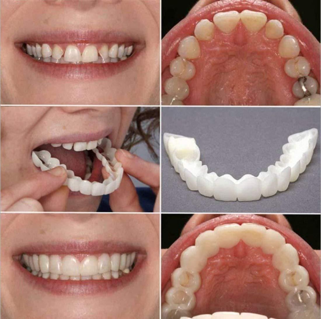 Instant Smile Fit Flex™ – No Dentist Cosmetic Teeth